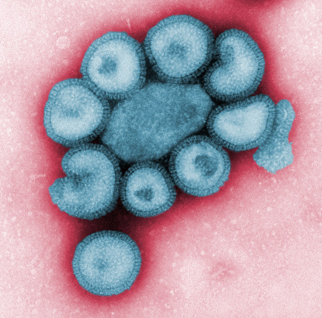 Influenza A-HK-1-68-H3N2-FAM colorized